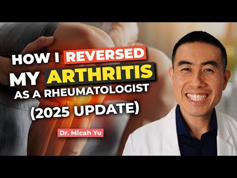 How I REVERSED my ARTHRITIS NATURALLY as a Rheumatologist | 2025 Update