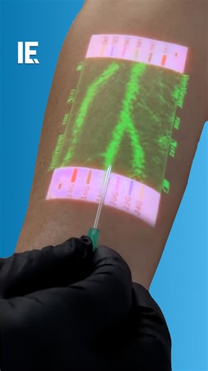 861K views · 1.6K reactions | You can see your veins live during an injection with this medical tool. : christiemedical / IG | Interesting Engineering | Facebook