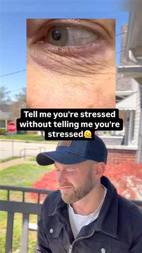 James Moore on Instagram: "Eye twitching is called myokymia — it’s a small, involuntary spasm of the eyelid muscles, usually the lower lid. Common Causes of Eye Twitching: 1. Stress – Major trigger; emotional or physical stress often sets it off. 2. Fatigue / Lack of Sleep – Not enough rest can trigger nerve misfires. 3. Caffeine – Too much coffee, energy drinks, or stimulants. 4. Eye Strain – Long screen time or needing glasses without realizing it. 5. Dry Eyes – Especially common in people ove