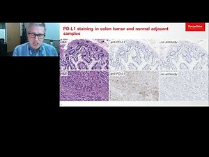 Verifying immunooncology-related gene expression patterns in colon tumor research samples