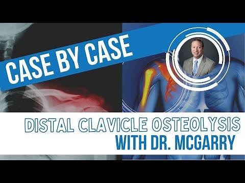 What is Distal Clavicle Osteolysis?