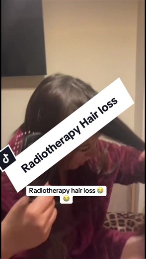 Understanding Radiotherapy-Induced Hair Loss