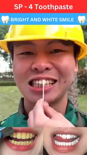 88K views · 227 reactions | 醴✨ Say goodbye to yellow stains & hello to a sparkling smile!  Get your Whitening Toothpaste SP 4 today and shine with confidence   Removes tough stains  Fresh mint breath all day  Strengthens teeth & gums  Safe for daily use Buy now & make every smile camera-ready!  #WhiteningToothpaste #BrightSmile #OralCare #FreshBreath | Offers India | Facebook