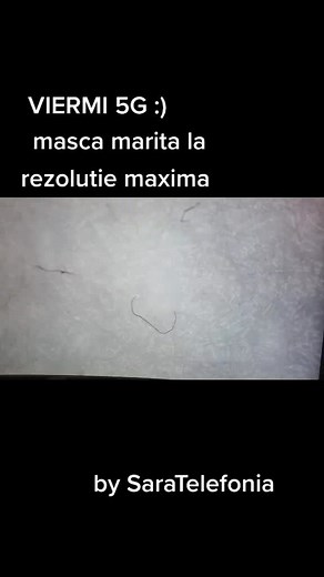 Exploring 5G Technology and Resolution Impact