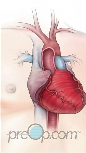 Cardiac Catheterization