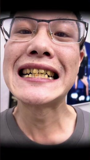 Sbianca i denti in 15 secondi con questo trucco shock! 😱