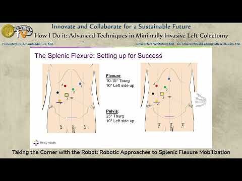 Taking the Corner with the Robot: Robotic Approaches to Splenic Flexure Mobilization