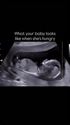 11K views · 31K reactions | “Did you know your baby actually drinks...