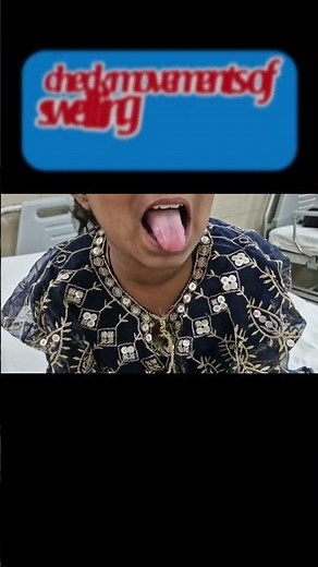 Thyroid Swelling vs Thyroglossal Cyst: Know the Difference! | Goiter Examination #thyroiddisorder