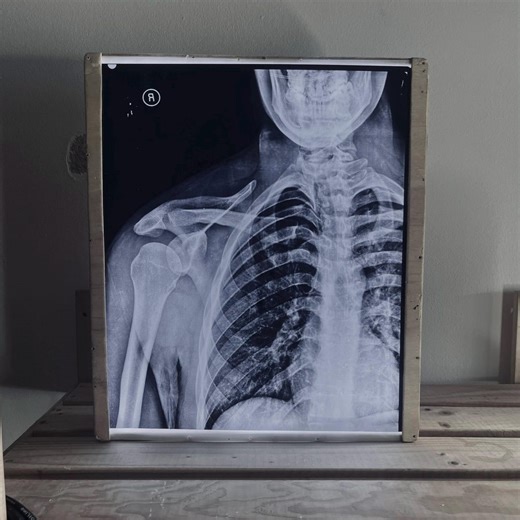 Classic Radiographic X-ray Films – 14x17 - Etsy