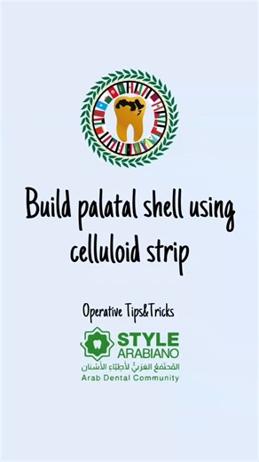 How to build palatal shell using celluloid strip Operative Tips&Tricks Credit @artium_esthetics #stylearabiano #stylearabianoteam #composite #esthetics | Style Arabiano