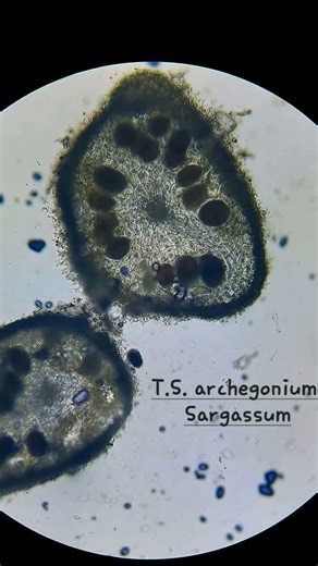 T.S. of Archegonium of Sargassum | Structure, Development & Function #algae #biology #science