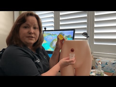 Ask the STN | How to collect a urine specimen from a urostomy?