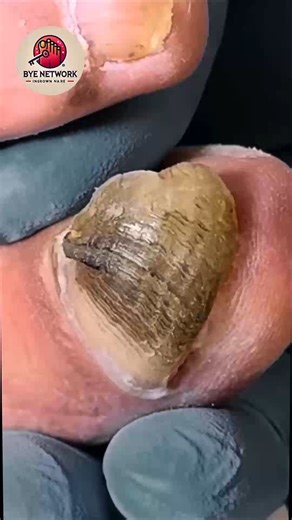 196. Research highlights on HEPA purifiers and comfort #AirQuality #HomeCare #RespiratoryWellness | Bye