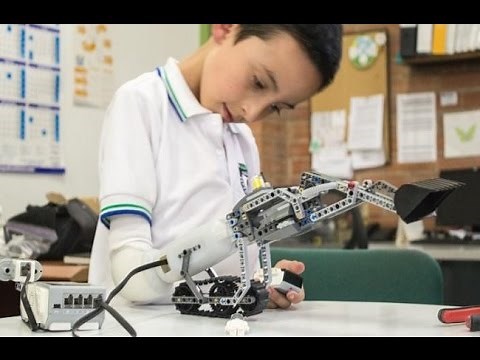 Lego compatible prosthetic arm lets kids build their own hand