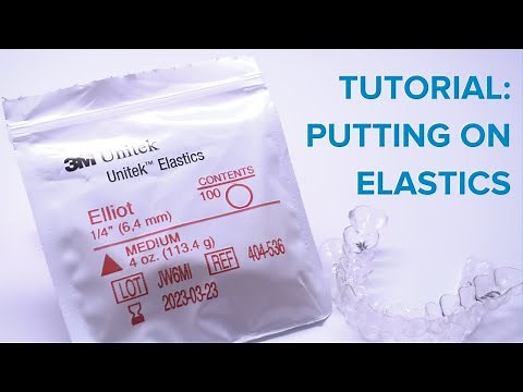 Holliday Orthodontics: How to Put On Rubber Bands - Class III Bite