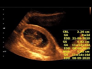 Inside 9 Weeks Pregnancy || Fetal Development and Ultrasound Insights