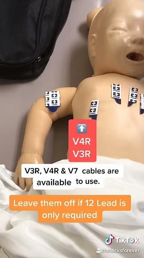 ECG 4: 15 Lead Electrocardiogram (ECG) placement