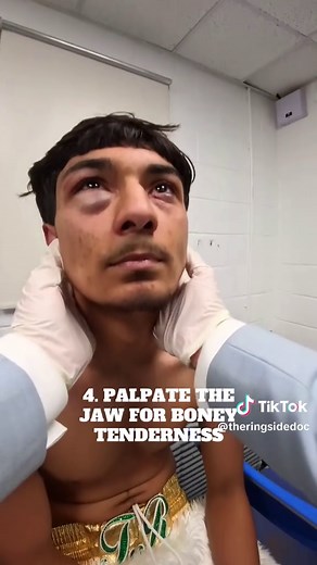 How to Assess Head Injuries in Boxing: Doctor's Insight