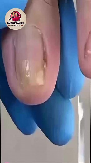 Routine Daily Care for Aging Nails and Feet #FootSupport #HealthyHabits #EverydayCare | Bye