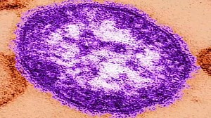 Child under 18 is Harris County's first case of measles since 2019, health officials say