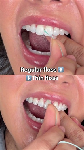 Did you know you have to find the right floss thickness for your teeth? #floss