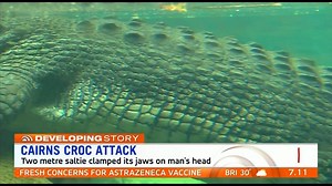 51K views · 18 reactions | A man is recovering in a Far North Queensland hospital after he was attacked by a crocodile at a popular swimming hole. The man was very lucky to survive. www.7NEWS.com.au #7NEWS | 7NEWS Brisbane | Facebook