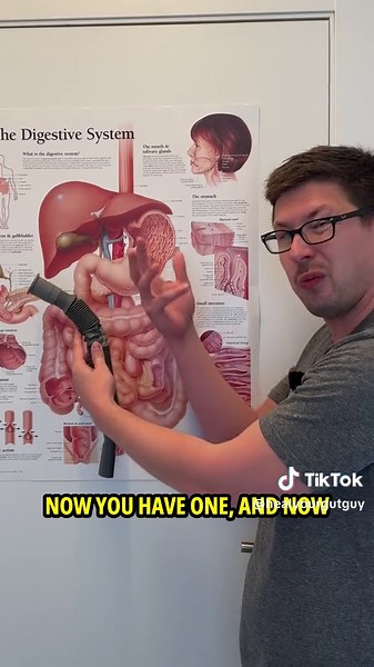 Understanding Diarrhea Causes in IBS and Colitis