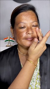 11K views · 316 reactions | Makeup transformation on hyperpigmentation skin.. Step by step with products detail.. #makeuptutorial #transformation #hyperpigmentation | Make Up Artist Manalisha | Facebook