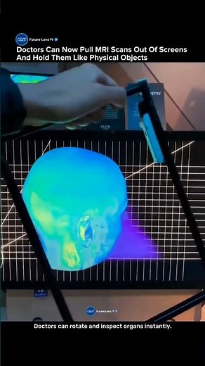 Doctors Can Now Hold MRI Scans Like Real 3D Objects #3d #mri #tech