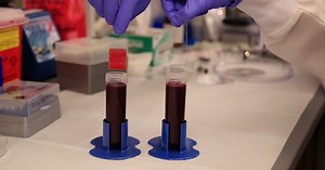 Surface coating for medical devices prevents blood clotting and bacterial infections