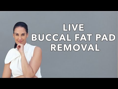 Buccal Fat Removal Surgery + Before and After Photos | Nazarian Plastic Surgery