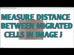 Wound healing assay analysis by image J II xgene and proteinx