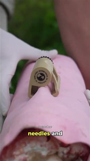 This device stops bleeding in seconds! 😲