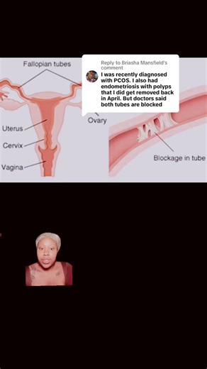 Natural Ways to Unblock Fallopian Tubes: Holistic Remedy Package