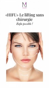 134 reactions · 36 shares | HIFU 朗 PROMOTION SUR LES TARIFS À SAISIR...