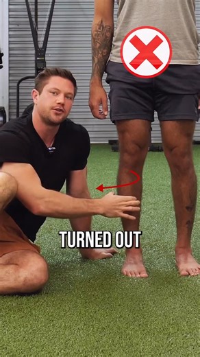 Conor Harris on Instagram: "Here’s why this matters a lot: When we bend our knee, the femur and tibia (leg and shin) need to internally rotate. This is a necessary mechanism that allows for our knee to properly manage and distribute pressures/forces evenly throughout our legs as we load them. The problem is, this knee presentation represents a knee that is stuck in external rotation. This means that the mechanics of the knee bending and the shin moving forward over the toes are going to be compr