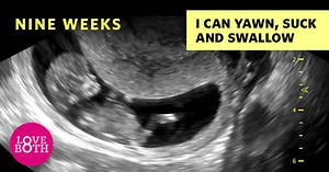 2.4K reactions · 732 shares | Stop and consider the wonder of human life. It’s science. Ultrasound verified by Consultant Obstetrician Dr John Monaghan | LoveBoth Project | Facebook