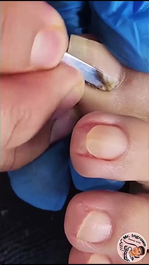 Easy Nail Cleaning at Home | Clean & Fresh Nails! #nails #cleaning