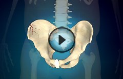 3 Simple Exercises for Pelvic Fracture - Epainassist - Useful Information for Better Health