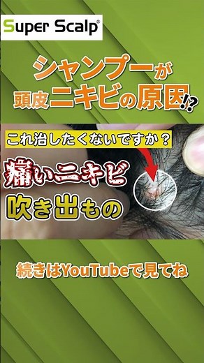 [Understand in 1 minute] A hair growth expert explains the causes of scalp acne and pimples and t...