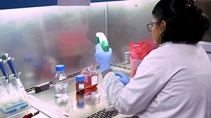 Quantification of Circular RNAs Using Digital Droplet PCR