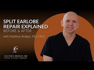 Split Earlobe Repair Explained (Before & After) w/ Matthew Bridges, MD, FACS