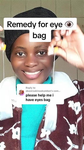 Effective Remedies for Eye Bags at Home