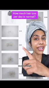 144K views · 242 reactions | Are you losing too much hair? Here’s how...