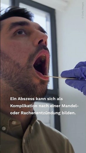 Pain when swallowing: When you urgently need to see a doctor #pain #sick