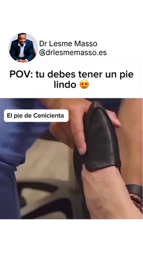 Dr Lesme | Hormonas y Adelgazamiento on Instagram: "🦶✨ ¿Tienes un pie de Cenicienta? ¡Cuidado con la salud podal! Tener pies “bonitos” no siempre significa tener pies saludables. 👣 Problemas comunes en pies aparentemente normales: • Juanetes (hallux valgus) • Dedos en martillo • Fascitis plantar • Callosidades por mala pisada • Uñas encarnadas por calzado estrecho • Dolor crónico por falta de soporte ⚠️ Y lo peor: muchas personas no se dan cuenta hasta que el dolor aparece. 💡 Recomendaciones 