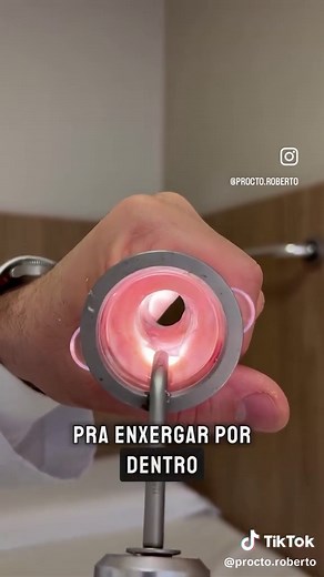 Entenda o Anoscópio: Importância e Funcionamento