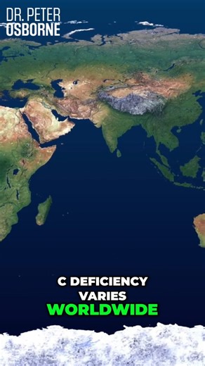 21 reactions | Scurvy - It's More Common Than You Think, Watch Out! #scurvy #vitaminc #vitamincdeficiency | Dr. Peter Osborne | Facebook