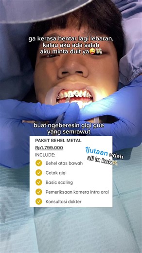 Izin minta duit 1jtan ya nanti pas lebaran buat pasang behel metal hihihi 😋🙏🏻 #behel #behelgigi #behelstory #korbansozodental